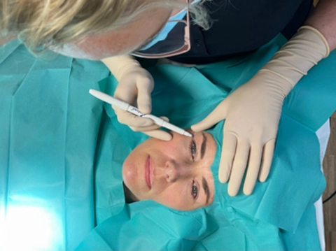 Ooglidcorrecties op maat